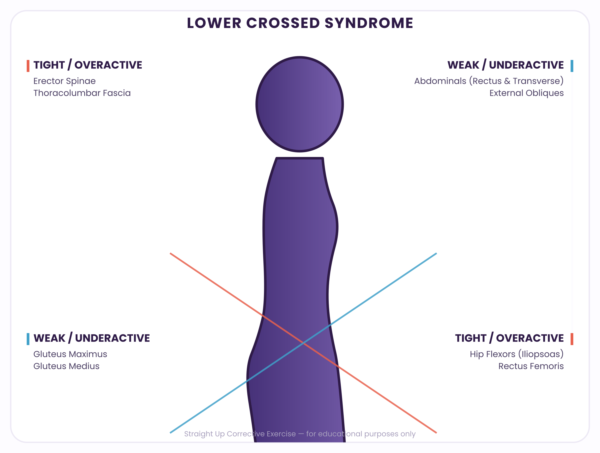 Lower Crossed Syndrome