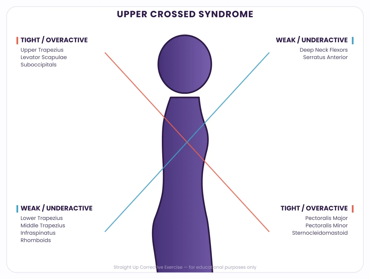 Upper Crossed Syndrome